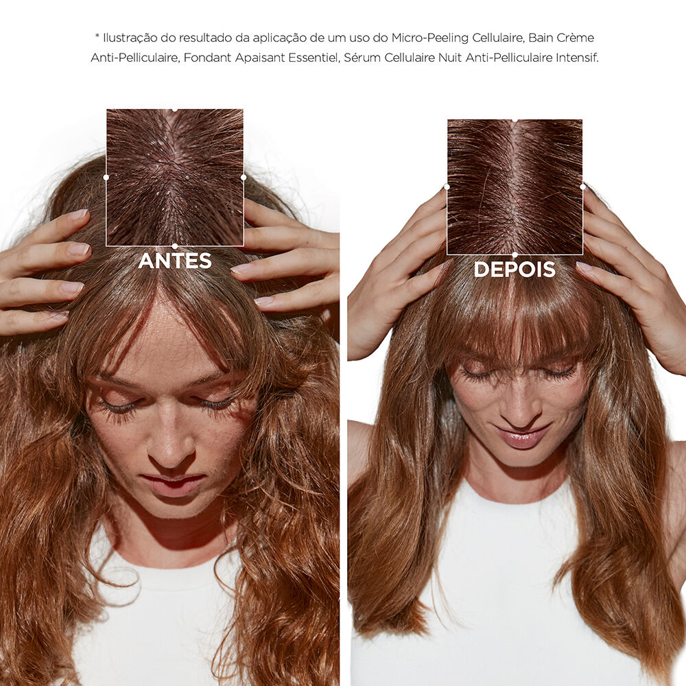 Micro-Peeling Cellulaire Symbiose Kerastase