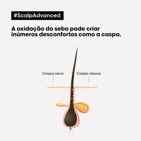 Shampoo Anticaspa Scalp Advanced L'Oreal Professionnel 300ml