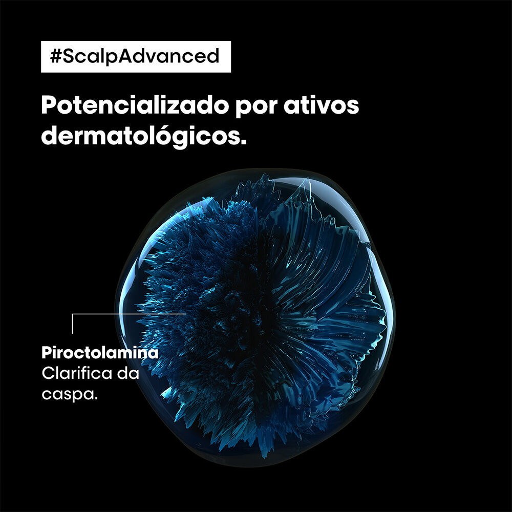 Shampoo Anticaspa Scalp Advanced L'Oreal Professionnel 300ml