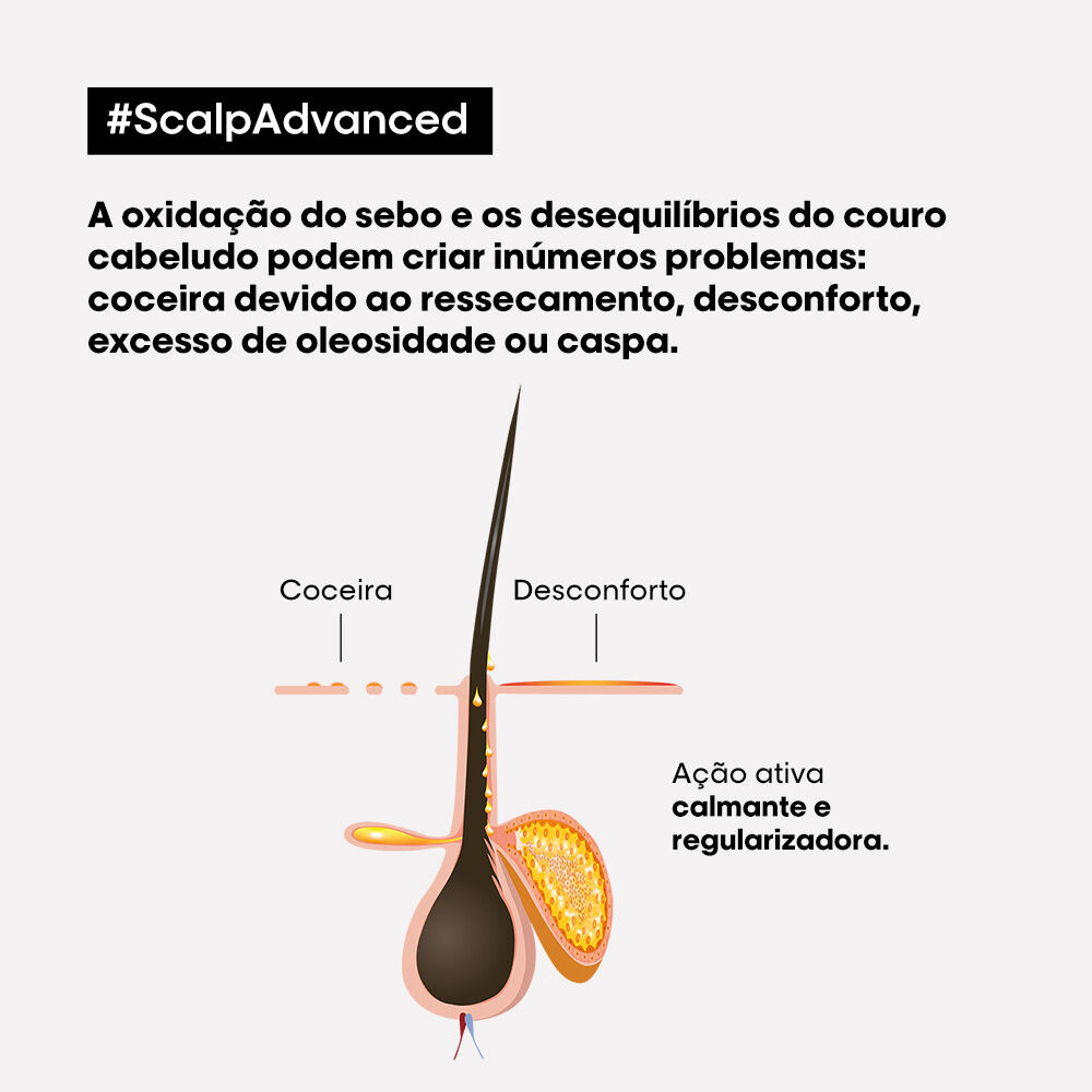 Tratamento Calmante Intensivo Intense Soother Scalp Serie Expert L'Oreal Professionnel 200ml