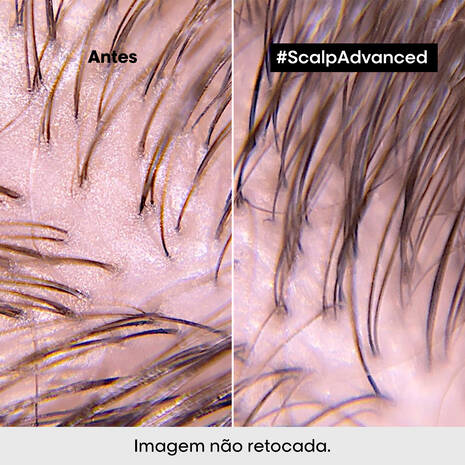 Shampoo Purificante Dermo Purifier Scalp Serie Expert L'Oreal Professionnel